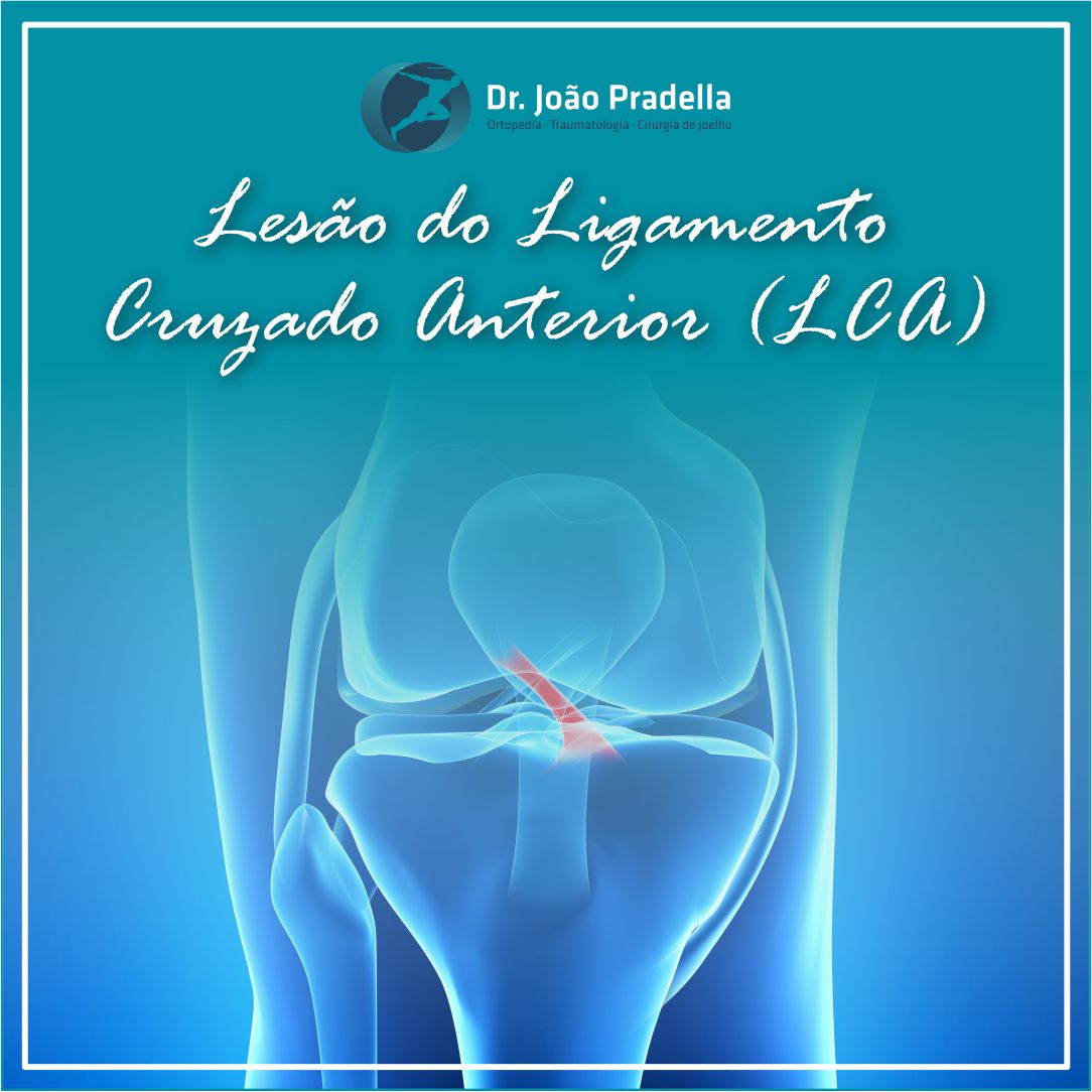 ligamento pélvico anterior